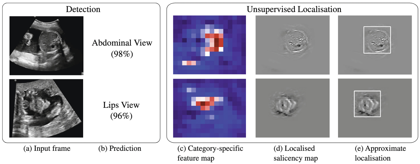 Real-Time Standard Scan Plane Detection and Localisation in Fetal Ultrasound Using Fully Convolutional Neural Networks